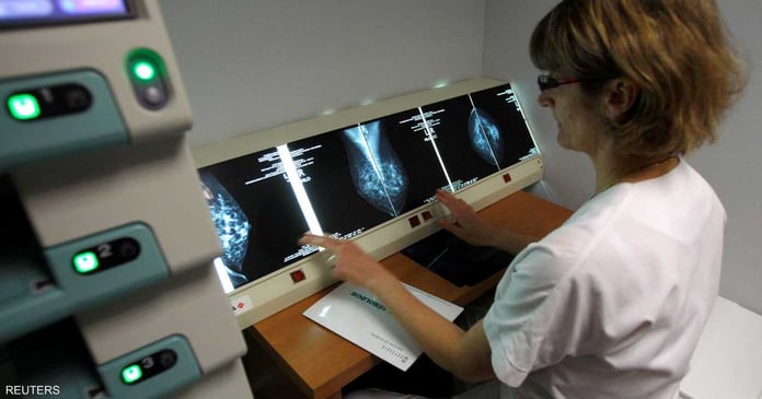 With a new recommendation... Changing the age required for breast cancer screening

