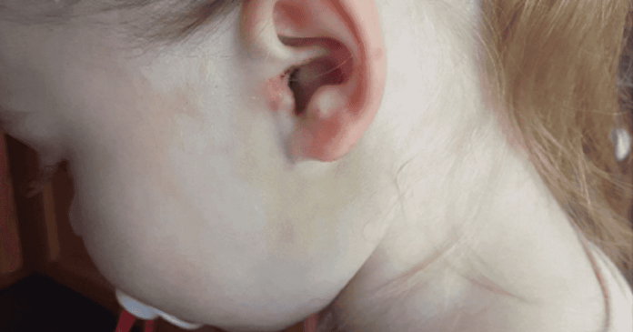 A mother's shock at what she found in her child's ear...and a warning to parents

